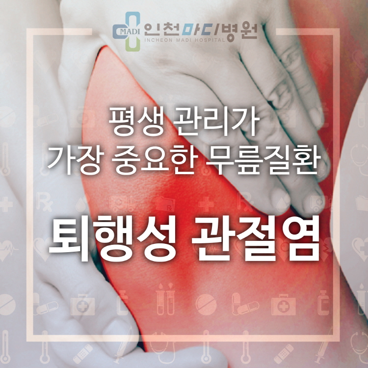 퇴행성 관절염 치료는 악화 방지가 최우선