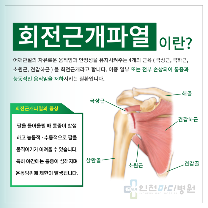 팔을 들어올릴 때 발생하는 통증, '회전근개파열'