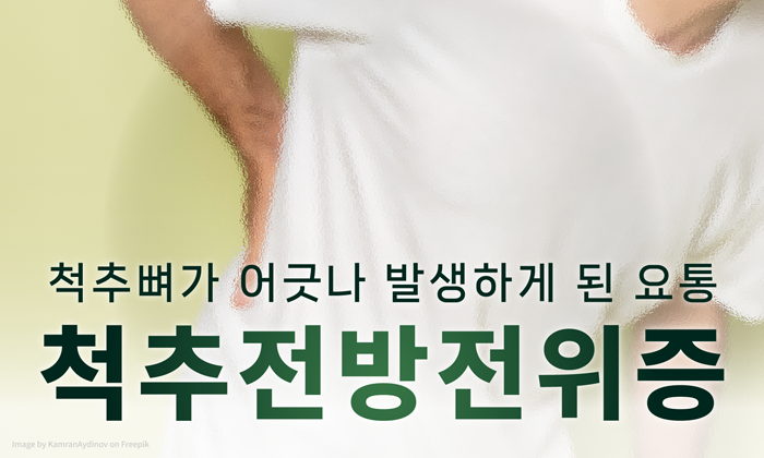 허리가 아픈 원인? 뼈가 움직이는 척추전방전위증