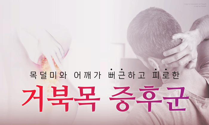 두통의 날 확인해야 하는 거북목 증후군