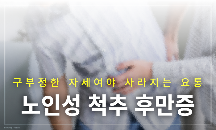 허리가 굽어지는 노인성 '척추 후만증' 원인부터 치료까지