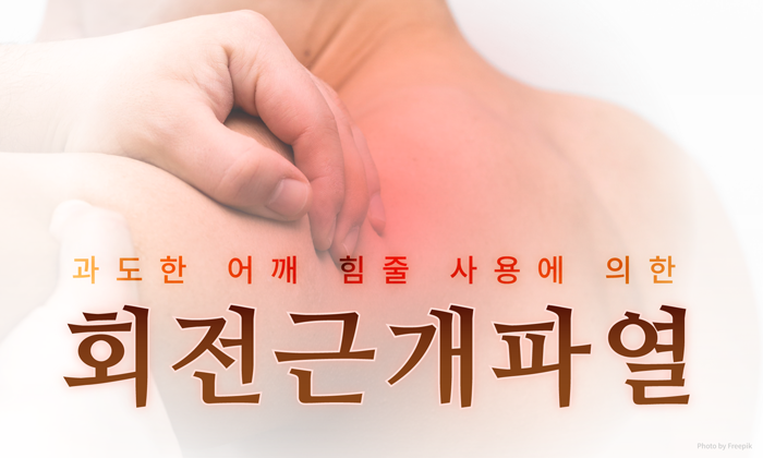 어깨회전근개파열 확인 방법, 정말 수술만이 답일까?