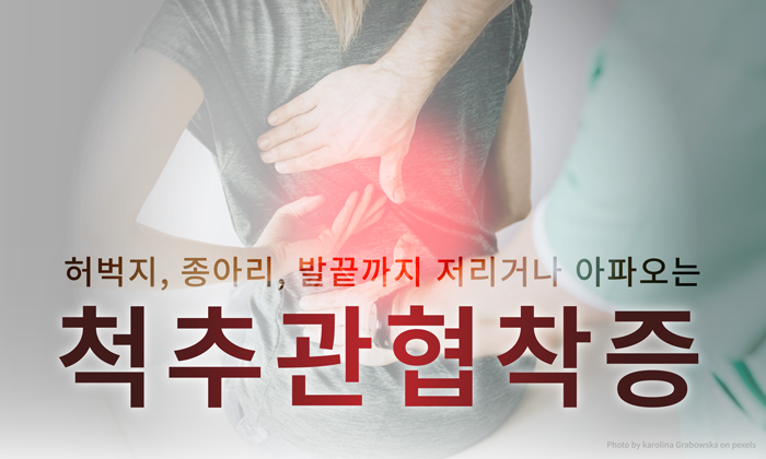 서서히 진행되는 허리통증 - 양방향 내시경수술에 대하여