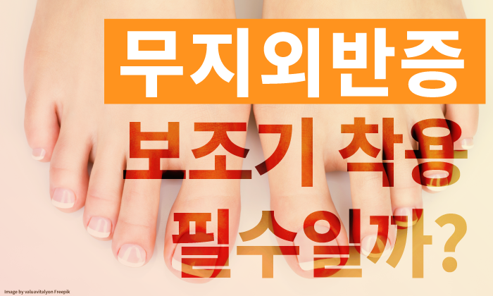 무지외반증 치료에 보조기 착용 필수일까?