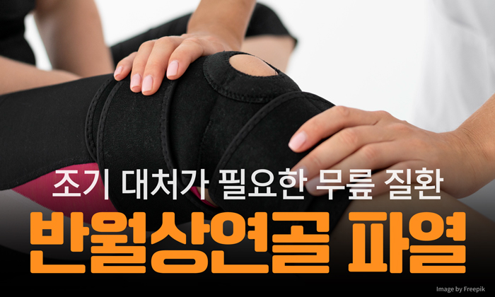 반월상연골파열 대처 방법과 치료 방법 살펴보기