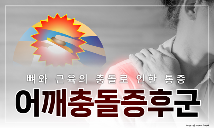 ﻿젊은 층도 방심할 수 없는 어깨 충돌 증후군