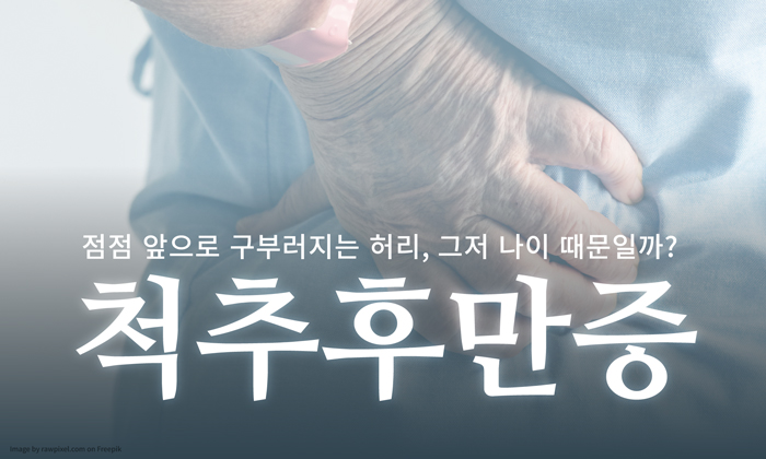 ﻿나이들어 등이 굽어지는 '꼬부랑병' 원인은 근력 때문